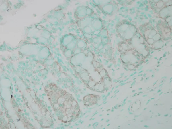 Immunohistochemistry (Formalin/PFA-fixed paraffin-embedded sections) - Anti-Ubiquitin antibody (AB223613)