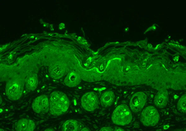 Immunohistochemistry (Formalin/PFA-fixed paraffin-embedded sections) - Anti-Ubiquitin antibody (AB223613)