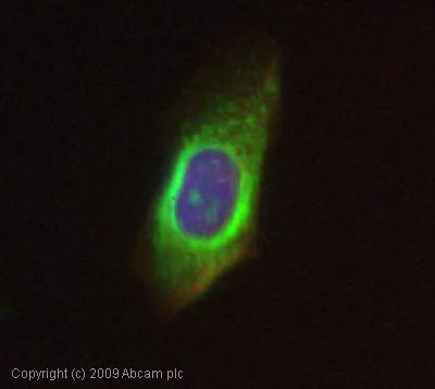 Immunocytochemistry/ Immunofluorescence - Anti-Ubiquitin antibody (AB7780)