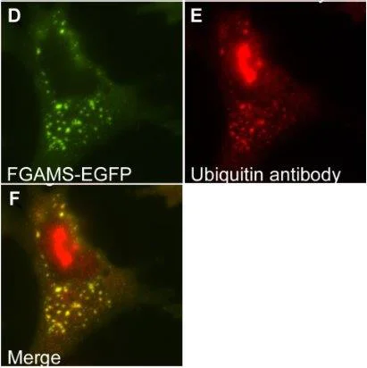 Immunocytochemistry/ Immunofluorescence - Anti-Ubiquitin antibody (AB7780)