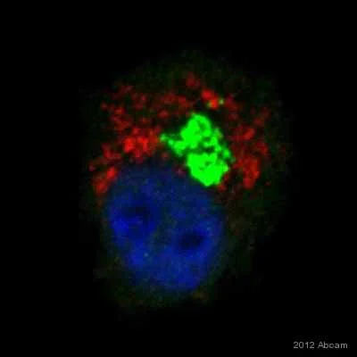 Immunocytochemistry/ Immunofluorescence - Anti-Ubiquitin antibody (AB7780)