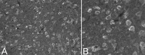 Immunohistochemistry - Free Floating - Anti-Ubiquitin antibody (AB7780)