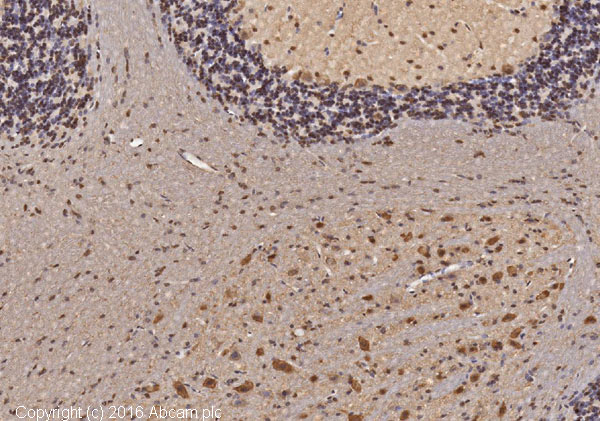 Immunohistochemistry (Formalin/PFA-fixed paraffin-embedded sections) - Anti-Ubiquitin antibody [EP296Y] (AB33893), expandable thumbnail
