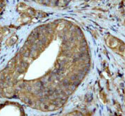 Immunohistochemistry (Formalin/PFA-fixed paraffin-embedded sections) - Anti-Ubiquitin antibody [EP296Y] (AB33893), expandable thumbnail