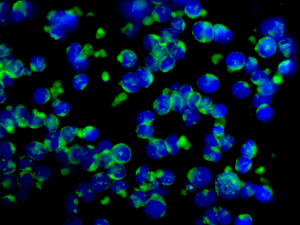 Immunocytochemistry/ Immunofluorescence - Anti-Ubiquitin antibody [EPR8589] (AB137031), expandable thumbnail