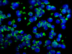 Immunocytochemistry/ Immunofluorescence - Anti-Ubiquitin antibody [EPR8589] - BSA and Azide free (AB248778)
