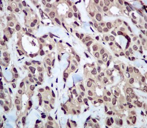 Immunohistochemistry (Formalin/PFA-fixed paraffin-embedded sections) - Anti-Ubiquitin antibody [EPR8590] - BSA and Azide free (AB248773), expandable thumbnail