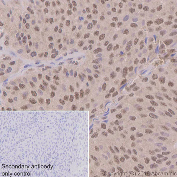 Immunohistochemistry (Formalin/PFA-fixed paraffin-embedded sections) - Anti-Ubiquitin antibody [EPR8830] (AB134953)