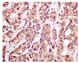 Immunohistochemistry (Formalin/PFA-fixed paraffin-embedded sections) - Anti-Ubiquitin antibody [EPR8830] (AB134953)