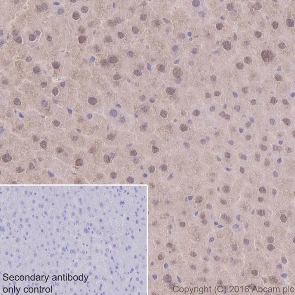 Immunohistochemistry (Formalin/PFA-fixed paraffin-embedded sections) - Anti-Ubiquitin antibody [EPR8830] (AB134953)