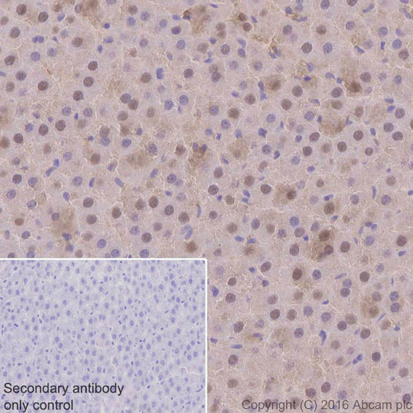 Immunohistochemistry (Formalin/PFA-fixed paraffin-embedded sections) - Anti-Ubiquitin antibody [EPR8830] (AB134953), expandable thumbnail