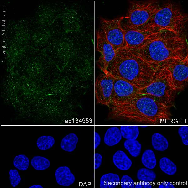 Immunocytochemistry/ Immunofluorescence - Anti-Ubiquitin antibody [EPR8830] - BSA and Azide free (AB230145)