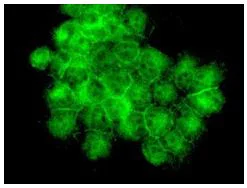 Immunocytochemistry/ Immunofluorescence - Anti-Ubiquitin antibody [EPR8830] - BSA and Azide free (AB230145)