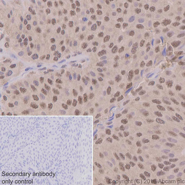 Immunohistochemistry (Formalin/PFA-fixed paraffin-embedded sections) - Anti-Ubiquitin antibody [EPR8830] - BSA and Azide free (AB230145), expandable thumbnail