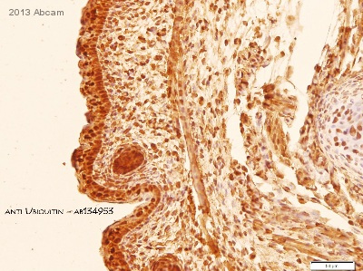 Immunohistochemistry (Formalin/PFA-fixed paraffin-embedded sections) - Anti-Ubiquitin antibody [EPR8830] - BSA and Azide free (AB230145), expandable thumbnail