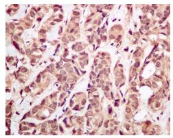 Immunohistochemistry (Formalin/PFA-fixed paraffin-embedded sections) - Anti-Ubiquitin antibody [EPR8830] - BSA and Azide free (ab230145), expandable thumbnail