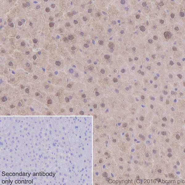 Immunohistochemistry (Formalin/PFA-fixed paraffin-embedded sections) - Anti-Ubiquitin antibody [EPR8830] - BSA and Azide free (AB230145), expandable thumbnail