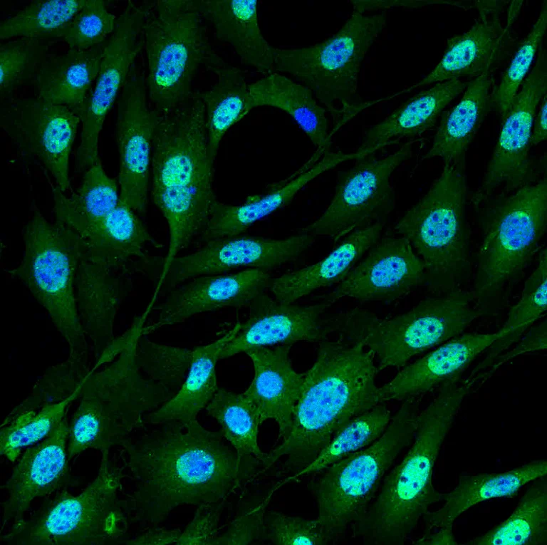 Immunocytochemistry/ Immunofluorescence - Anti-Ubiquitin antibody [FK2] (AB326354)