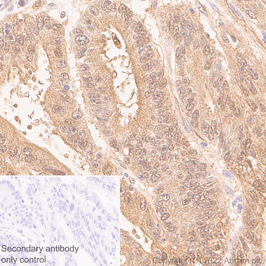 Immunohistochemistry (Formalin/PFA-fixed paraffin-embedded sections) - Anti-Ubiquitin antibody [P4D1] (AB303664)