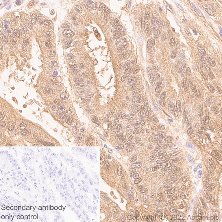 Immunohistochemistry (Formalin/PFA-fixed paraffin-embedded sections) - Anti-Ubiquitin antibody [P4D1] (AB303664)