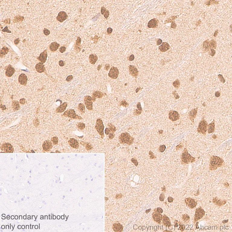 Immunohistochemistry (Formalin/PFA-fixed paraffin-embedded sections) - Anti-Ubiquitin antibody [P4D1] (AB303664)