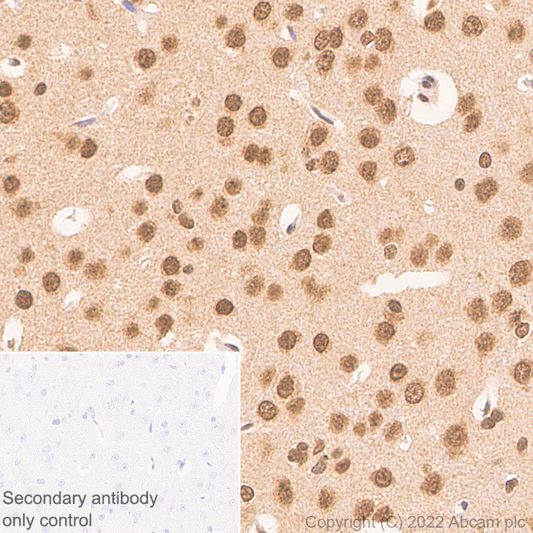 Immunohistochemistry (Formalin/PFA-fixed paraffin-embedded sections) - Anti-Ubiquitin antibody [P4D1] (AB303664)