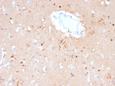 Immunohistochemistry (Formalin/PFA-fixed paraffin-embedded sections) - Anti-Ubiquitin antibody [UBB/2122] - BSA and Azide free (AB237925)
