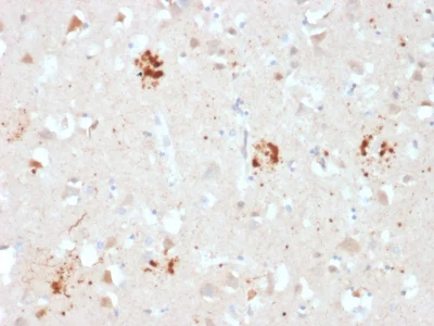 Immunohistochemistry (Formalin/PFA-fixed paraffin-embedded sections) - Anti-Ubiquitin antibody [UBB/2122] - BSA and Azide free (AB237925)
