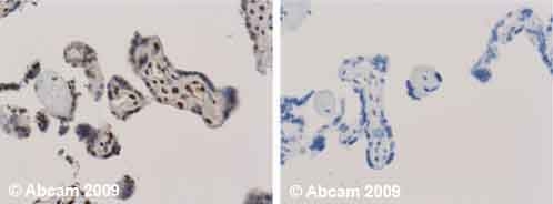 Immunohistochemistry (Formalin/PFA-fixed paraffin-embedded sections) - Anti-Ubiquitin antibody [Ubi-1] (AB7254), expandable thumbnail
