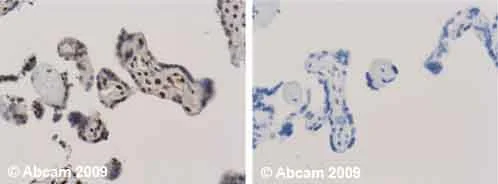 Immunohistochemistry (Formalin/PFA-fixed paraffin-embedded sections) - Anti-Ubiquitin antibody [Ubi-1] (AB7254)