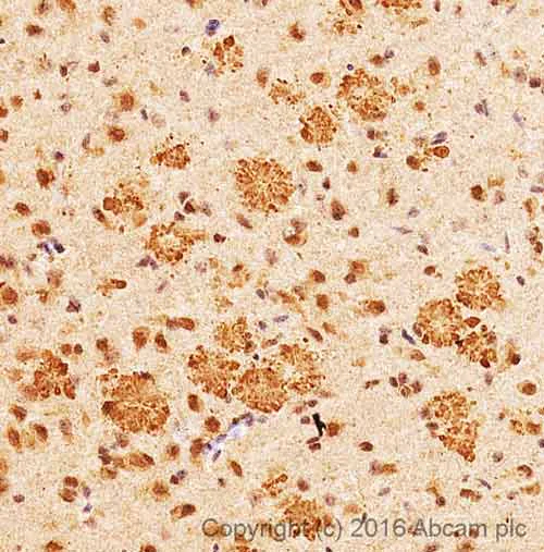 Immunohistochemistry (Formalin/PFA-fixed paraffin-embedded sections) - Anti-Ubiquitin antibody [Ubi-1] (AB7254)