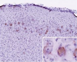Immunohistochemistry (Formalin/PFA-fixed paraffin-embedded sections) - Anti-Ubiquitin antibody [Ubi-1] (AB7254), expandable thumbnail