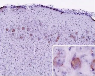 Immunohistochemistry (Formalin/PFA-fixed paraffin-embedded sections) - Anti-Ubiquitin antibody [Ubi-1] (AB7254)