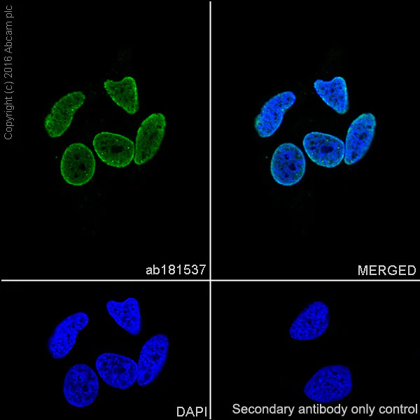 Immunocytochemistry/ Immunofluorescence - Anti-Ubiquitin (linkage-specific K27) antibody [EPR17034] (AB181537)