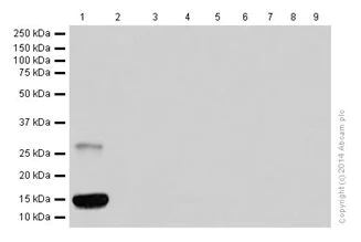 Western blot - Anti-Ubiquitin (linkage-specific K27) antibody [EPR17034] (AB181537)