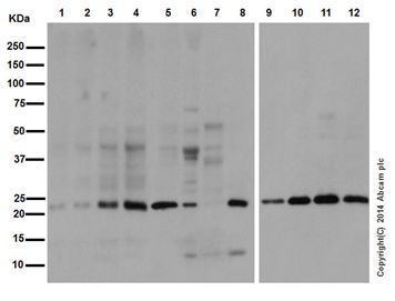 Western blot - Anti-Ubiquitin (linkage-specific K27) antibody [EPR17034] (AB181537), expandable thumbnail