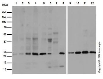 Western blot - Anti-Ubiquitin (linkage-specific K27) antibody [EPR17034] (AB181537)