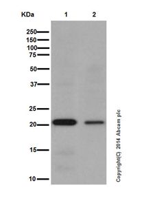 Western blot - Anti-Ubiquitin (linkage-specific K27) antibody [EPR17034] (AB181537), expandable thumbnail