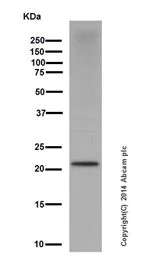 Western blot - Anti-Ubiquitin (linkage-specific K27) antibody [EPR17034] (AB181537)