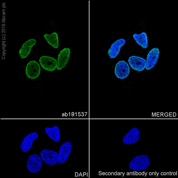 Immunocytochemistry/ Immunofluorescence - Anti-Ubiquitin (linkage-specific K27) antibody [EPR17034] - BSA and Azide free (AB238442), expandable thumbnail