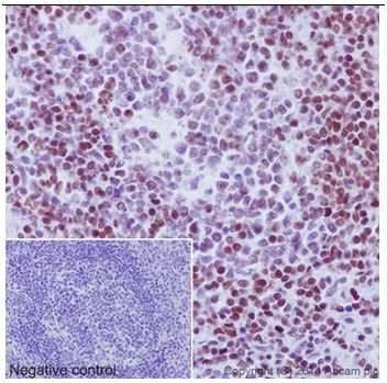 Immunohistochemistry (Formalin/PFA-fixed paraffin-embedded sections) - Anti-Ubiquitin (linkage-specific K27) antibody [EPR17034] - BSA and Azide free (AB238442), expandable thumbnail