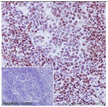 Immunohistochemistry (Formalin/PFA-fixed paraffin-embedded sections) - Anti-Ubiquitin (linkage-specific K27) antibody [EPR17034] - BSA and Azide free (AB238442)