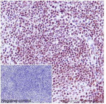 Immunohistochemistry (Formalin/PFA-fixed paraffin-embedded sections) - Anti-Ubiquitin (linkage-specific K27) antibody [EPR17034] - BSA and Azide free (AB238442), expandable thumbnail