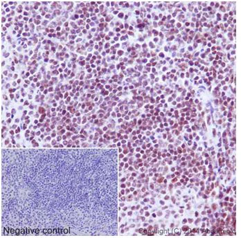 Immunohistochemistry (Formalin/PFA-fixed paraffin-embedded sections) - Anti-Ubiquitin (linkage-specific K27) antibody [EPR17034] - BSA and Azide free (AB238442)