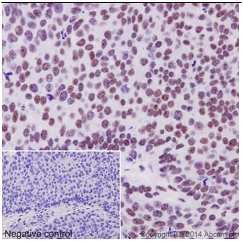 Immunohistochemistry (Formalin/PFA-fixed paraffin-embedded sections) - Anti-Ubiquitin (linkage-specific K27) antibody [EPR17034] - BSA and Azide free (AB238442), expandable thumbnail