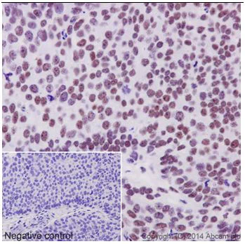 Immunohistochemistry (Formalin/PFA-fixed paraffin-embedded sections) - Anti-Ubiquitin (linkage-specific K27) antibody [EPR17034] - BSA and Azide free (AB238442)