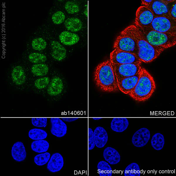 Immunocytochemistry/ Immunofluorescence - Anti-Ubiquitin (linkage-specific K48) antibody [EP8589] (AB140601)