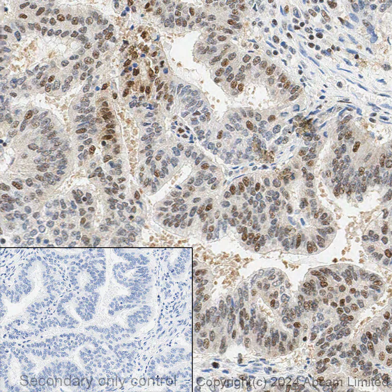 Immunohistochemistry - Anti-Ubiquitin (linkage-specific K48) antibody [EP8589] (AB140601)