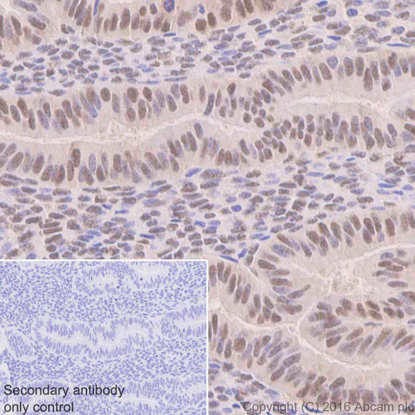 Immunohistochemistry (Formalin/PFA-fixed paraffin-embedded sections) - Anti-Ubiquitin (linkage-specific K48) antibody [EP8589] - BSA and Azide free (AB271911)