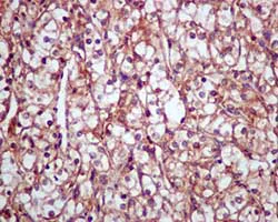 Immunohistochemistry (Formalin/PFA-fixed paraffin-embedded sections) - Anti-Ubiquitin (linkage-specific K63) antibody [EPR8590-448] (AB179434)